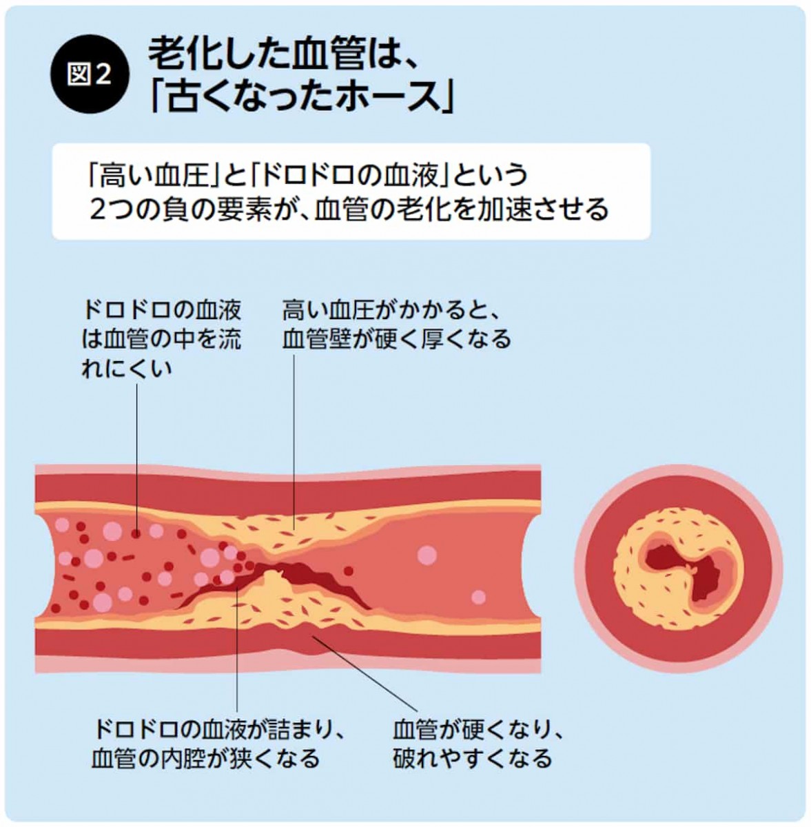 老化した欠陥は古くなったホース